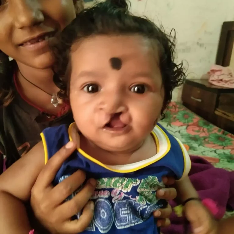 चिरायु योजना ने लौटाई मासूमों की मुस्कान