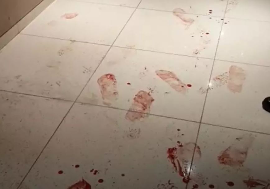 रायपुर : अपार्टमेंट में चाकूबाजी, बिल्डर ने वारदात को दबाया रायपुर : अपार्टमेंट में चाकूबाजी, बिल्डर ने वारदात को दबाया