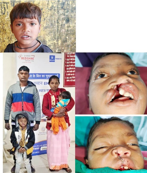 खिलखिलाती मुस्कान की नई इबारत लिख रहा बस्तर के वनांचल से नन्हा विक्रम