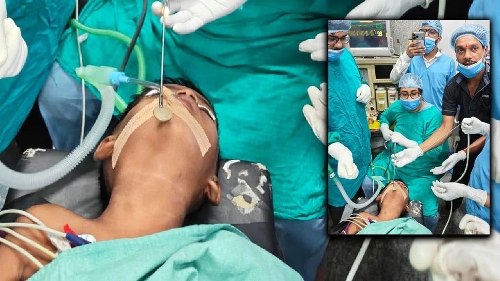 सिम्स में चमत्कार: 5 साल के बच्चे के गले से एंडोस्कोपी से निकाला सिक्का, बची जान